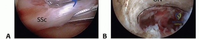 Clinical Image