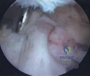 Clinical Image