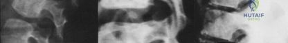 Clinical Image