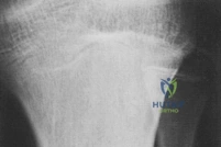 Clinical Image