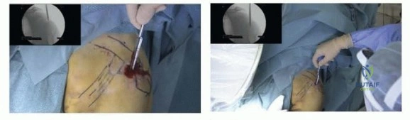 Clinical Image