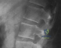 Clinical Image