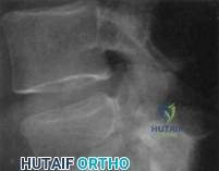 Clinical Image