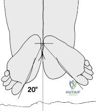 Clinical Image
