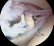 Clinical Image
