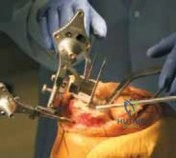 Clinical Image