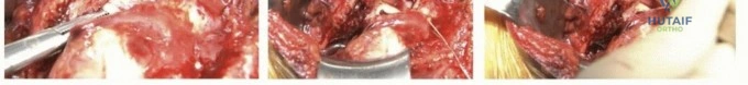 Clinical Image