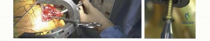 Clinical Image