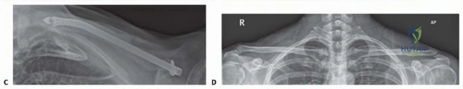 Clinical Image