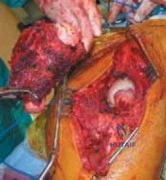 Clinical Image