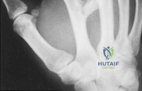 Clinical Image
