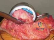Clinical Image