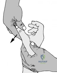 Clinical Image