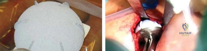 Clinical Image