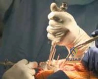 Clinical Image