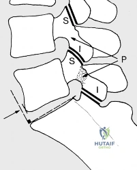 Clinical Image