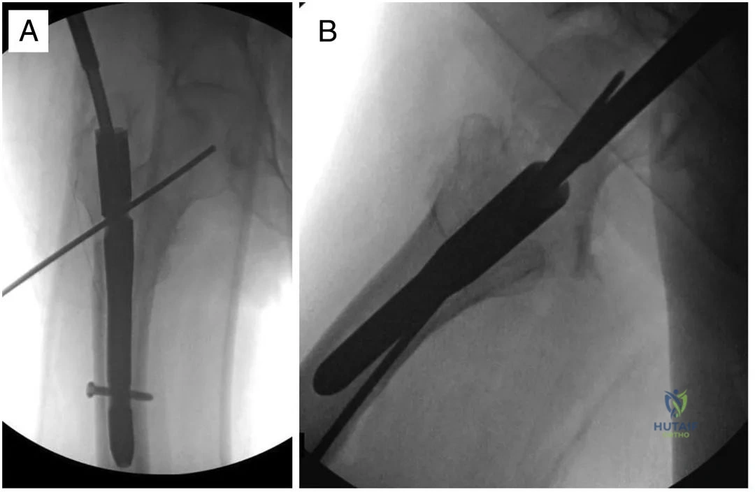 Clinical Image