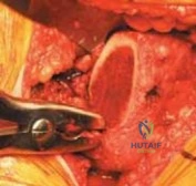Clinical Image