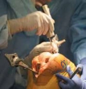 Clinical Image
