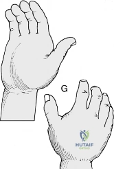 Clinical Image