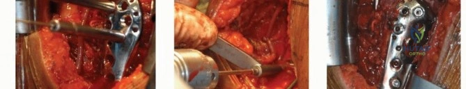 Clinical Image