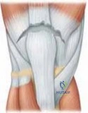 Clinical Image