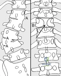 Clinical Image