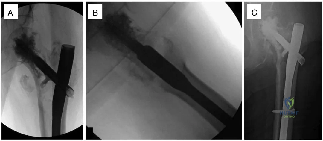 Clinical Image