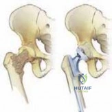 Clinical Image