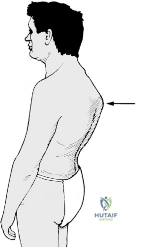 Clinical Image