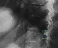 Clinical Image