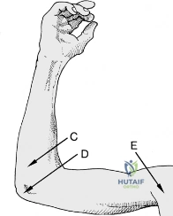 Clinical Image
