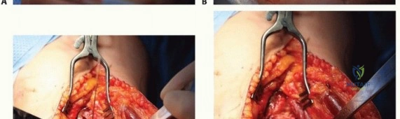 Clinical Image