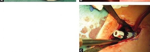 Clinical Image