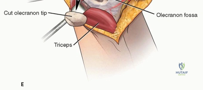 Clinical Image