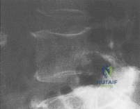 Clinical Image