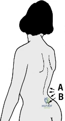 Clinical Image