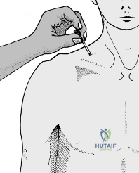 Clinical Image