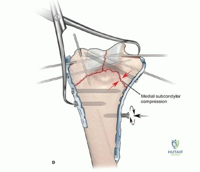 Clinical Image