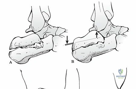 Clinical Image