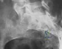 Clinical Image