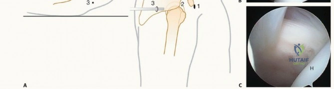 Clinical Image