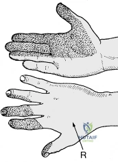 Clinical Image