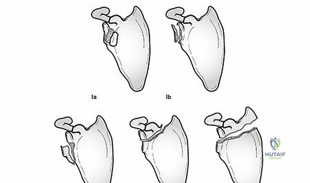 Clinical Image