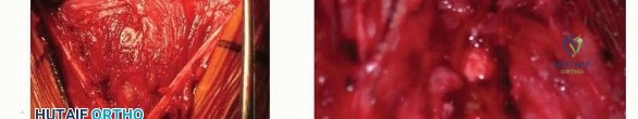 Clinical Image
