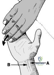 Clinical Image