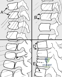 Clinical Image