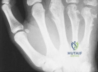 Clinical Image