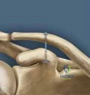 Clinical Image