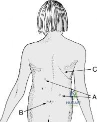 Clinical Image